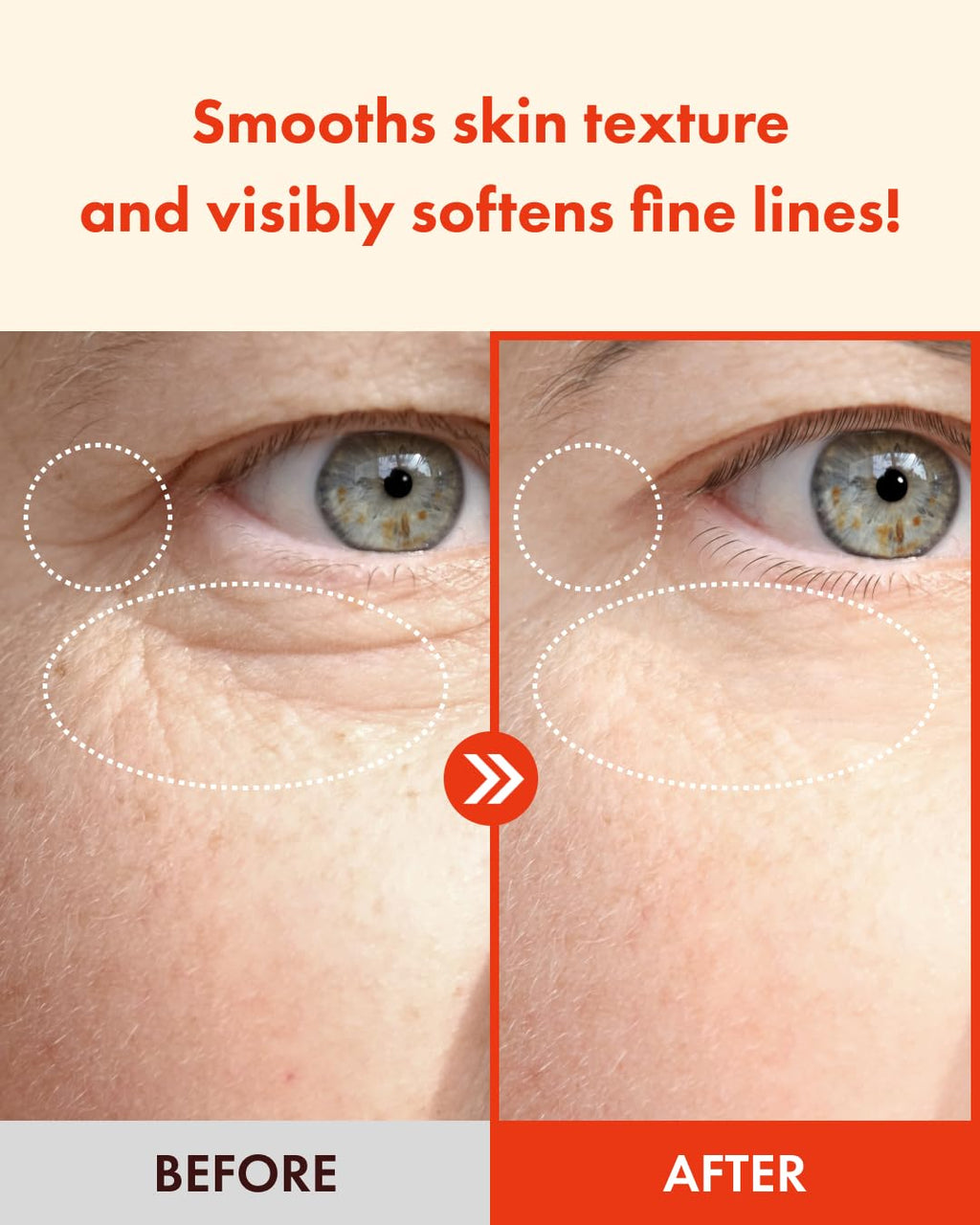 It'S SKIN Retinoidine Eye Cream 25ml