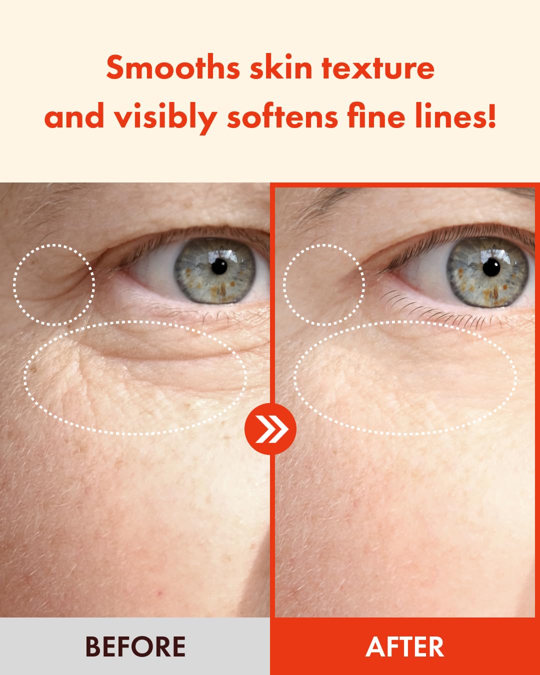 It'S SKIN Retinoidine Eye Cream 25ml