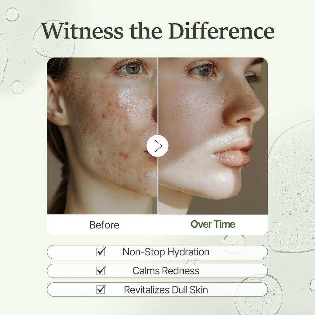 It'S SKIN Prestige Intense Calming Teatree Cica Gel Mask(10ea)