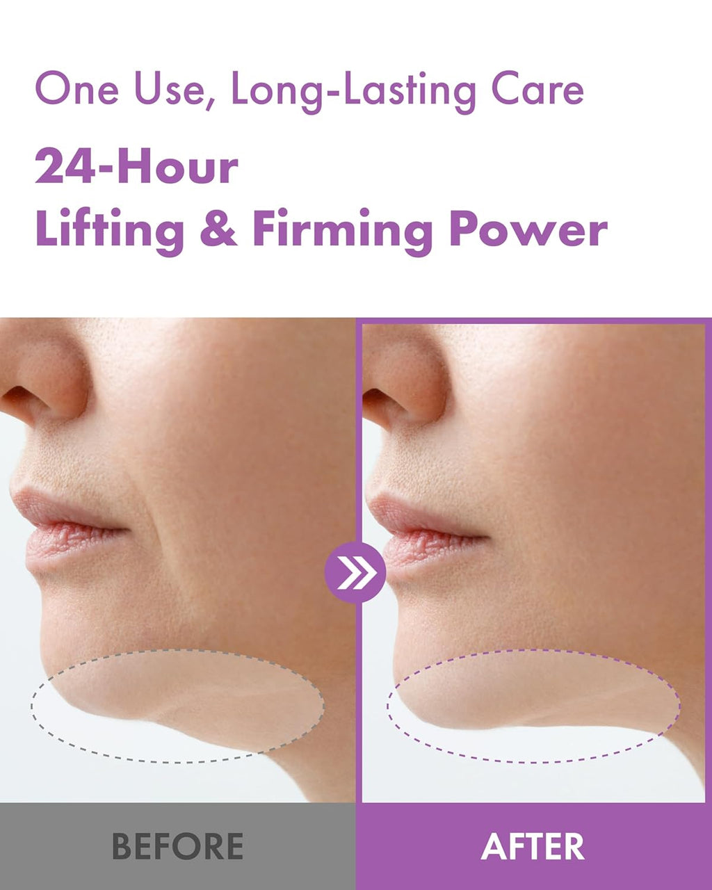 It'S SKIN 7-Peptide Collagen Thread Lifting Mini Gel Mask 20ea, Real Collagen Lifting Patches for Firming, Tightening and Skin Elasticity, Korean Skincare